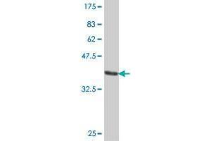 Western Blot detection against Immunogen (37.