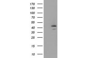 Image no. 1 for anti-serpin Peptidase Inhibitor, Clade B (Ovalbumin), Member 4 (SERPINB4) antibody (ABIN1500890)