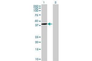 Lane 1: AP3M2 transfected lysate ( 47 KDa) Lane 2: Non-transfected lysate. (AP3M2 293T Cell Transient Overexpression Lysate(Denatured))