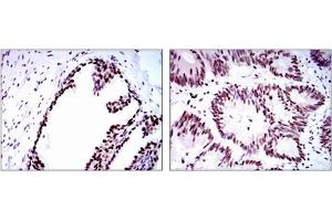 Immunohistochemistry (IHC) image for anti-Replication Protein A1, 70kDa (RPA1) antibody (ABIN1108896) (RPA1 抗体)