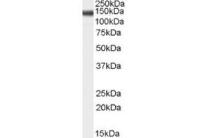 Western Blotting (WB) image for anti-Abhydrolase Domain Containing 17C (ABHD17C) (Middle Region) antibody (ABIN2791515) (ABHD17C 抗体  (Middle Region))