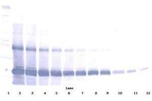 Image no. 3 for anti-AIMP1 / EMAP II antibody (ABIN465272) (AIMP1 / EMAP II 抗体)