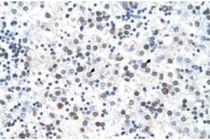 Immunohistochemical staining (Formalin-fixed paraffin-embedded sections) of human liver with FECH polyclonal antibody  at 4-8 ug/mL working concentration. (FECH 抗体  (N-Term))