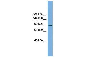 RAPGEF3 antibody used at 1 ug/ml to detect target protein.