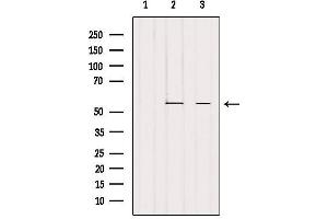Western Blotting (WB) image for anti-Prostaglandin I2 (Prostacyclin) Synthase (PTGIS) (Internal Region) antibody (ABIN6259069)