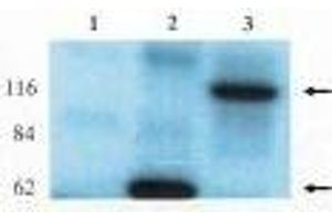 Western blot analysis using anti-Lfc antibody on HEK-293 cell transfected with vector alone (1), lfc-short (2) and lfc-long (3). (ARHGEF2 抗体)