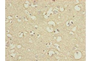 Immunohistochemistry of paraffin-embedded human brain tissue using ABIN7151390 at dilution of 1:100 (ENPP6 抗体  (AA 31-330))