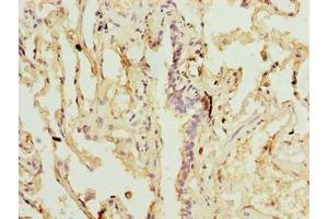 Immunohistochemistry of paraffin-embedded human lung tissue using ABIN7170672 at dilution of 1:100 (SLA 抗体  (AA 2-276))