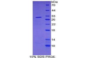 SDS-PAGE analysis of Human PDP Protein. (PDP 蛋白)