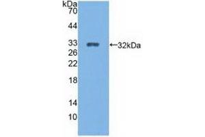 Detection of Recombinant CYP27B1, Rat using Polyclonal Antibody to Cytochrome P450 27B1 (CYP27B1) (CYP27B1 抗体  (AA 251-500))