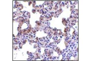 Immunohistochemistry of PEN2 in rat lung tissue with this product at 2. (PEN2 抗体  (N-Term))