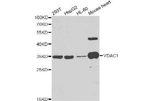 Western blot analysis of extracts of various cell lines, using VDAC1 antibody. (VDAC1 抗体)