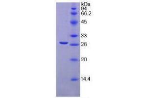 SDS-PAGE analysis of Mouse TGFbI Protein. (TGFBI 蛋白)