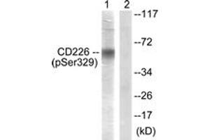 Western blot analysis of extracts from COS7 cells, using CD226/DNAM-1 (Phospho-Ser329) Antibody. (CD226 抗体  (pSer329))