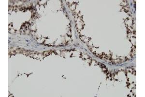 Image no. 1 for anti-PDZ Binding Kinase (PBK) (AA 1-110) antibody (ABIN599272) (PBK 抗体  (AA 1-110))