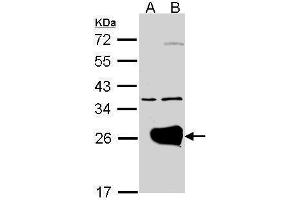 WB Image Western Blot analysis of RAB1A expression in transfected 293T cell line by RAB1A polyclonal antibody. (RAB1A 抗体)