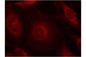 Image no. 2 for anti-V-Akt Murine Thymoma Viral Oncogene Homolog 1 (AKT1) (pTyr312), (pTyr315), (pTyr316) antibody (ABIN319269) (AKT1 抗体  (pTyr312, pTyr315, pTyr316))