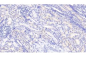 Detection of ACACb in Human Kidney Tissue using Polyclonal Antibody to Acetyl Coenzyme A Carboxylase Beta (ACACb) (Acetyl-CoA Carboxylase beta 抗体  (AA 29-249))