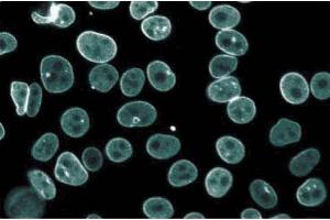 Immunofluorescence staining of HeLa cells (Human cervical epitheloid carcinoma, ATCC CCL-2. (Thymopoietin 抗体  (AA 34-156))
