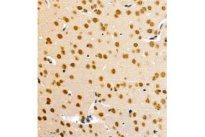 Immunohistochemistry of paraffin embedded mouse brain using HES3 (ABIN7074159) at dilution of 1:1000 (400x lens) (HES3 抗体)