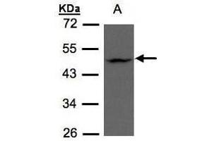 Western Blotting (WB) image for anti-Zinc Finger, DHHC-Type Containing 13 (ZDHHC13) (C-Term) antibody (ABIN2856295)