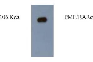 Western Blotting (WB) image for anti-Promyelocytic Leukemia (PML) antibody (ABIN452172) (PML 抗体)
