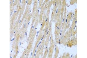 Immunohistochemistry of paraffin-embedded Rat heart using UBE2L3 Polyclonal Antibody at dilution of 1:100 (40x lens). (UBE2L3 抗体)
