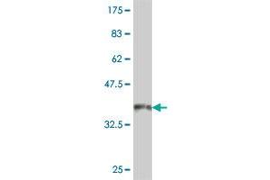 Western Blotting (WB) image for anti-Ubiquitin Specific Peptidase 14 (USP14) (AA 395-494) antibody (ABIN563938)