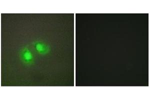 Immunofluorescence analysis of A549 cells, using TOP2A antibody. (Topoisomerase II alpha 抗体  (N-Term))