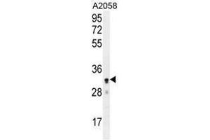 UBXN2A Antibody (C-term) western blot analysis in A2058 cell line lysates (35 µg/lane). (UBXN2A 抗体  (C-Term))