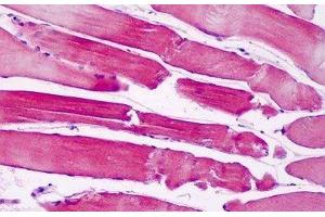 Human Skeletal Muscle: Formalin-Fixed, Paraffin-Embedded (FFPE) (PAK6 抗体  (AA 268-297))
