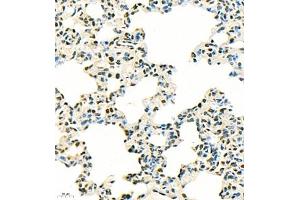 Immunohistochemistry of paraffin embedded rat lung using SUV39H1 (ABIN7075770) at dilution of 1:500 (400x lens) (SUV39H1 抗体)