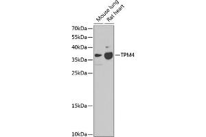 Western blot analysis of extracts of various cell lines, using TPM4 antibody (ABIN1683112, ABIN3018640, ABIN3018642 and ABIN6220525) at 1:1000 dilution. (Tropomyosin 4 抗体  (AA 1-248))