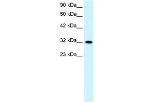 WB Suggested Anti-E2F5 Antibody Titration:  0. (E2F5 抗体  (N-Term))