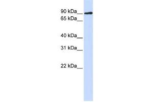 Western Blotting (WB) image for anti-DNA Cross-Link Repair 1C (DCLRE1C) antibody (ABIN2459465) (DCLRE1C 抗体)