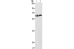 Western Blotting (WB) image for anti-Aminolevulinate, delta-, Synthase 2 (ALAS2) antibody (ABIN2422513) (ALAS2 抗体)