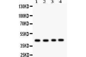 Western Blotting (WB) image for anti-Tumor Susceptibility Gene 101 (TSG101) (AA 361-390), (C-Term) antibody (ABIN3042318) (TSG101 抗体  (C-Term))