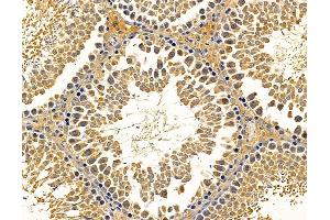ABIN7095701 and ABIN7099763 at 1/100 staining rat testis tissue by IHC-P. (SLC13A3 抗体)