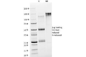 SDS-PAGE Analysis Purified NSE gamma Mouse Monoclonal Antibody (NSE-P2). (ENO2/NSE 抗体  (AA 416-433))