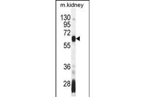 Western blot analysis in mouse kidney tissue lysates (35ug/lane). (AIRE 抗体  (AA 64-92))