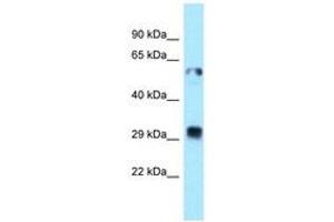 Image no. 1 for anti-Thioredoxin-Related Transmembrane Protein 1 (TMX1) (C-Term) antibody (ABIN6747966) (TMX1 抗体  (C-Term))