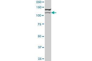 BCOR MaxPab polyclonal antibody. (BCOR 抗体  (AA 1-1004))