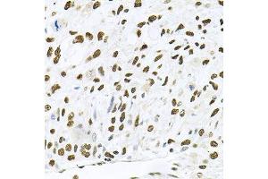 Immunohistochemistry (Paraffin-embedded Sections) (IHC (p)) image for anti-Mitogen-Activated Protein Kinase 8 (MAPK8) (AA 245-345) antibody (ABIN3020887)
