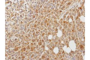 IHC-P Image Immunohistochemical analysis of paraffin-embedded SAS xenograft, using PCPE-1, antibody at 1:100 dilution. (PCOLCE 抗体)