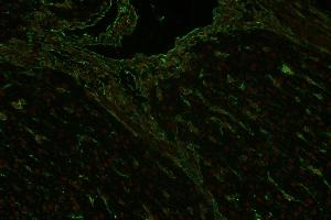 Immunohistochemistry staining (paraffin sections) of vimentin in human liver using mouse monoclonal antibody VI-RE/1 ((ABIN94494), diluted 1:400), detected with GAM IgG-Alexa Fluor488 (diluted 1:200, green), cell nuclei stained with PI (1 μg/mL, orange). (Vimentin 抗体)