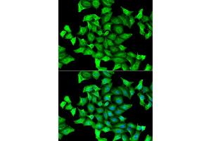 Immunofluorescence analysis of HeLa cells using SEPSECS antibody.