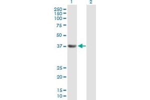Western Blot analysis of PDS5A expression in transfected 293T cell line by PDS5A MaxPab polyclonal antibody. (PDS5A 抗体  (AA 1-333))