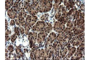 Image no. 2 for anti-Mannose Phosphate Isomerase (MPI) antibody (ABIN1499543) (MPI 抗体)