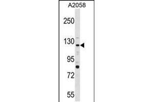 Western blot analysis in A2058 cell line lysates (35ug/lane). (PTPRN2 抗体  (N-Term))