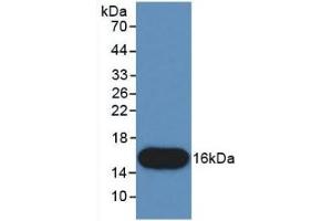 Detection of Recombinant CTGF, Human using Monoclonal Antibody to Connective Tissue Growth Factor (CTGF) (CTGF 抗体  (AA 80-200))